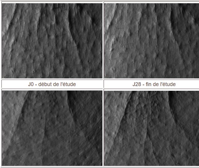 evaluation biometrologique de l effet anti rides